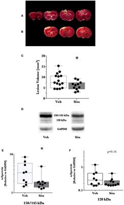 Oral Administration of Sitagliptin Activates CREB and Is Neuroprotective in Murine Model of <mark class="highlighted">Brain Trauma</mark>